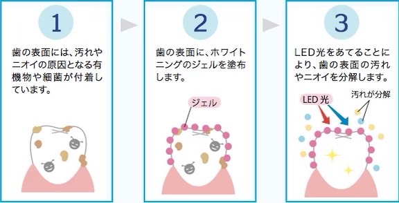 ホワイトニング画像